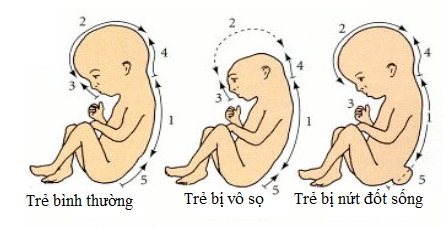 Hình ảnh: Trẻ bình thường và trẻ bị các vấn đề về dị tật bẩm sinh nghiêm trọng